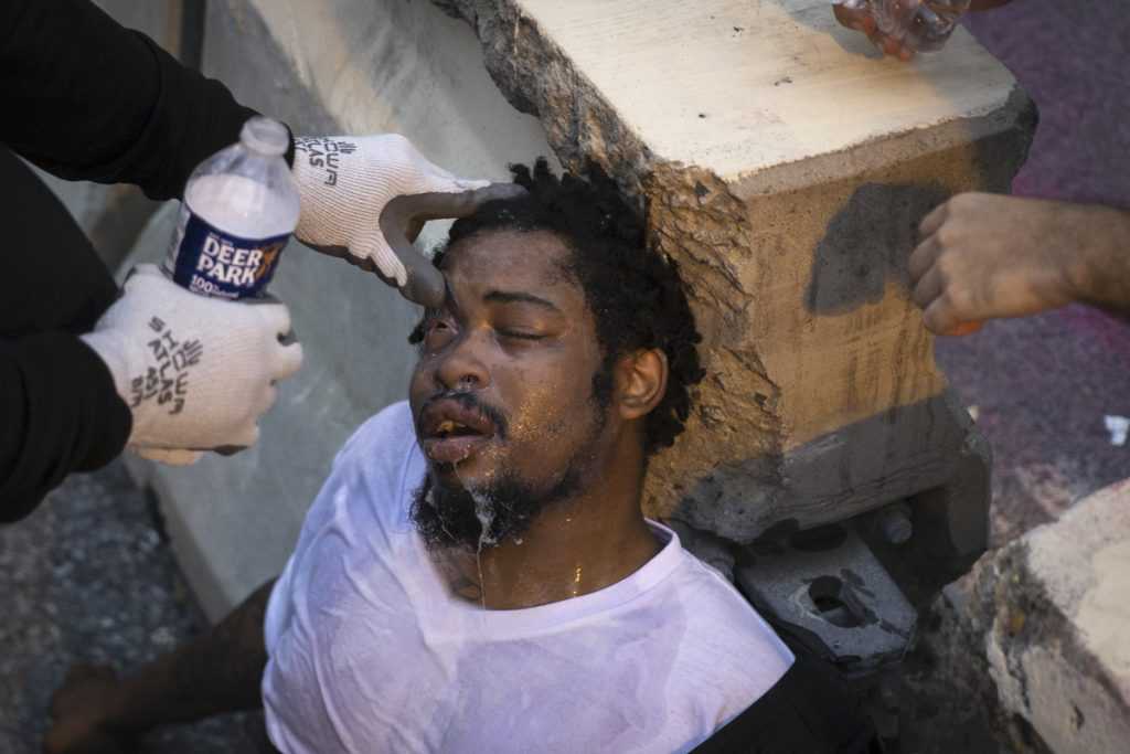 A man is tended to after being hit with pepper spray as protesters clash with US Park Police after they attempted to pull down the statue of former President Andrew Jackson in Lafayette Square near the White House on June 22 [Tasos Katopodis /Getty Images/AFP]