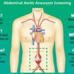 What is Abdominal Aortic Aneurysm (AAA)